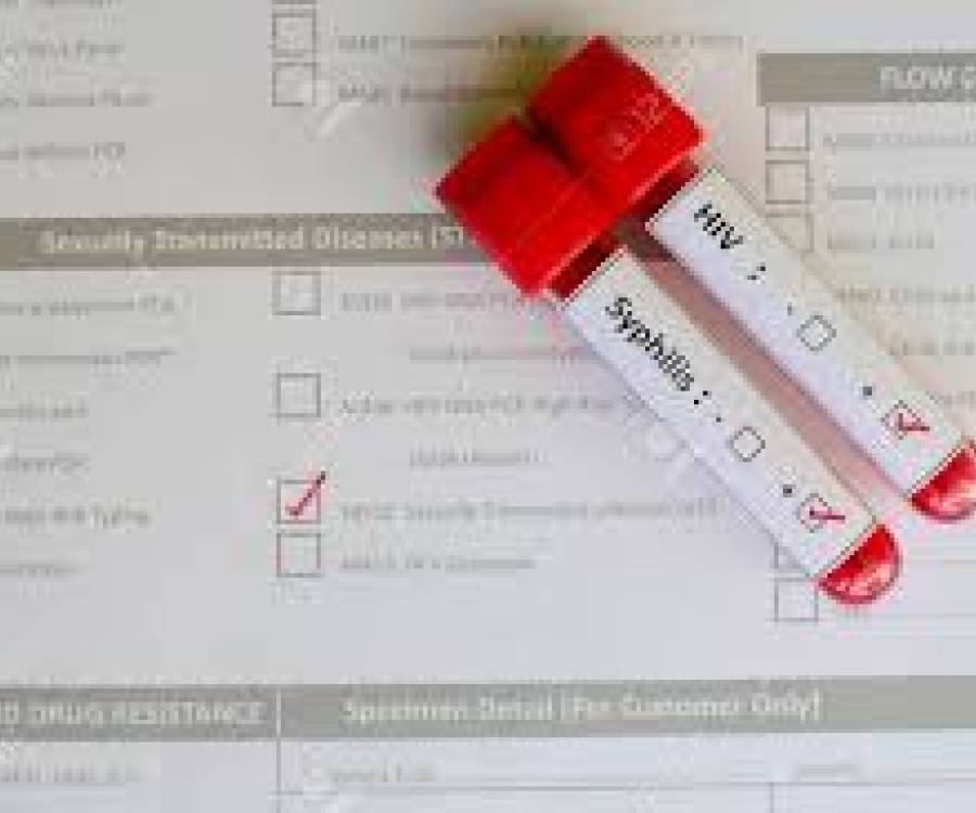 VIH y sífilis avanzan ante el ajuste oficial