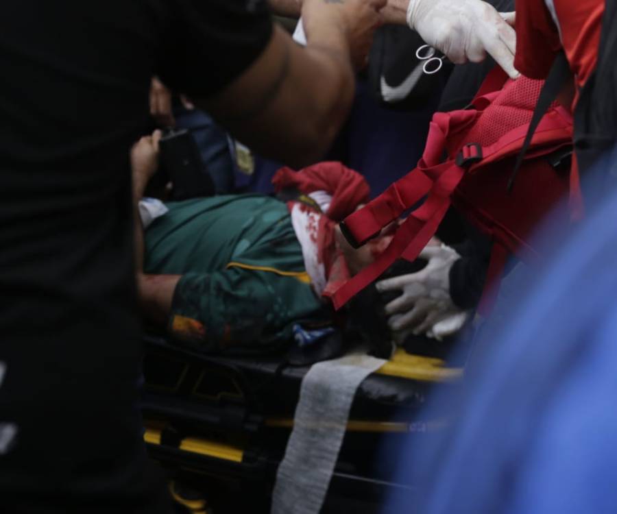 El fotógrafo Pablo Grillo está internado en gravísimo estado por un disparo en la cabeza con un tubo de gas lacrimógeno