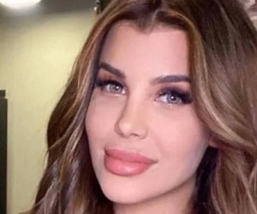 Charlotte Caniggia iniciará un juicio millonario tras hacerse una cirugía y quedar irreconocible